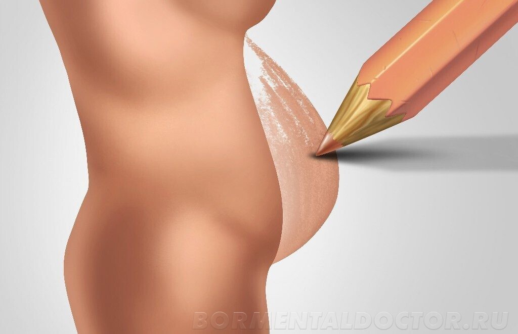 Как сбросить лишние килограммы после родов?