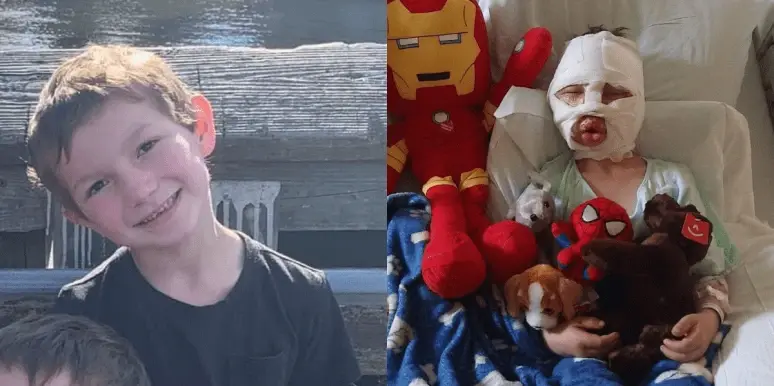 В США 8-летний соседский хулиган облил теннисный мяч бензином, поджег его и бросил в 6-летнего Доминика Крэнколла, который загорелся