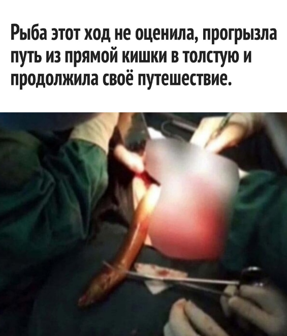 Народная медицина отдыхает или как китаец лечил запор с помощью угря