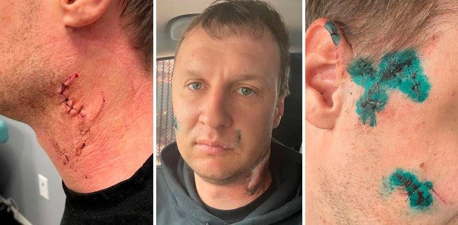 ❕Тесты на паляницу переехали в США