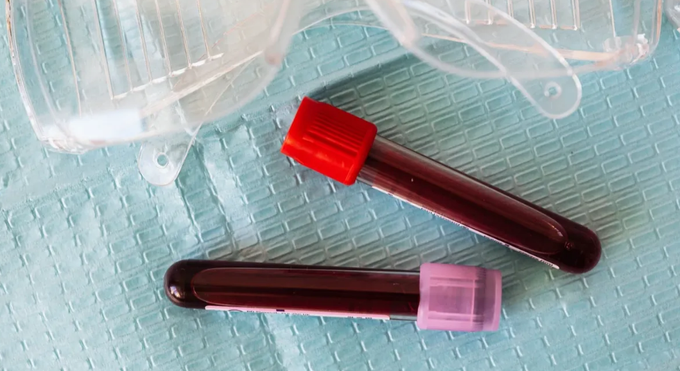 Какую группу крови считают самой стойкой к болезням – характеристика всех групп крови по склонности к заболеваниям