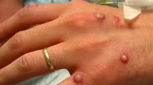 Биологическая разведка и обезьяны. Красные пришли