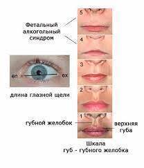 Поговорим о сперматозоидах?