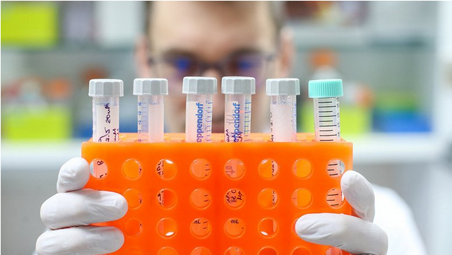 В СПбГУ научились выявлять рак по анализу мочи