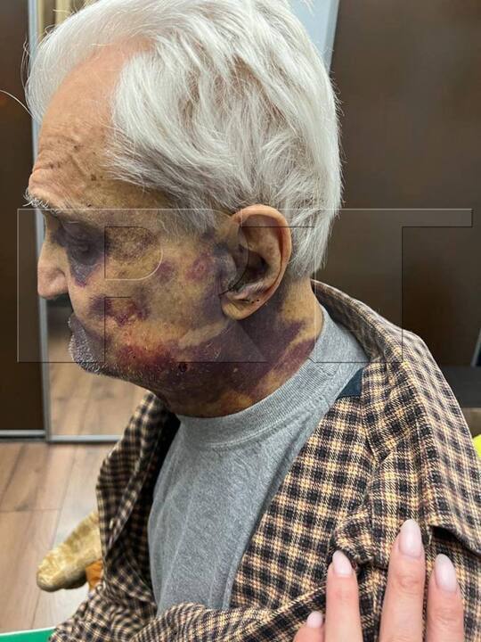 В Москве украинец избил 84-летнего подполковника за то, что он поддерживает спецоперацию.