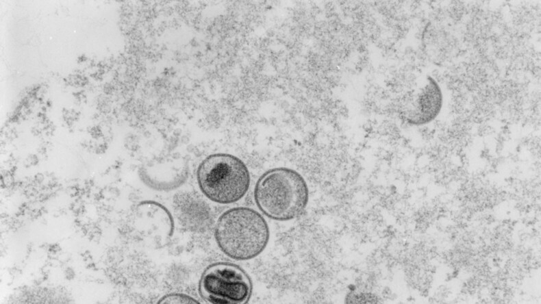 ЕС подписывает контракт на покупку более 100 000 вакцин против оспы обезьян