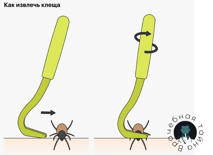 Клещей нельзя снимать самостоятельно?