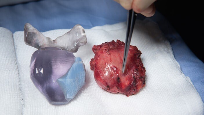 Зубной имплантат, протез стопы, кусок черепной коробки – в медицинской технике 3D-печать пользуется большим успехом.