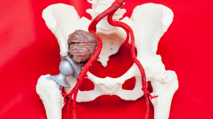 Зубной имплантат, протез стопы, кусок черепной коробки – в медицинской технике 3D-печать пользуется большим успехом.