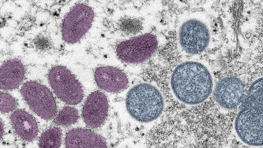 Врачи объявили оспу обезьян болезнью национального значения в Австралии.