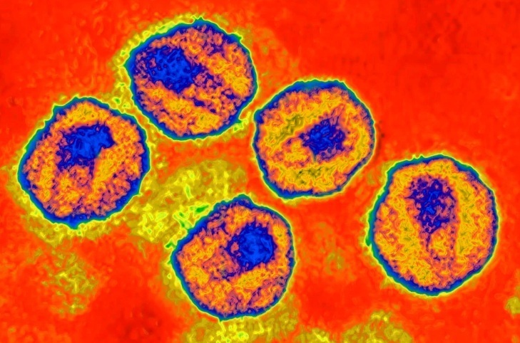 Пятый пациент достиг длительной ремиссии ВИЧ-инфекции благодаря пересадке стволовых клеток.