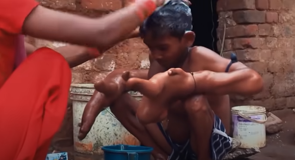 Мальчик с самыми большими руками