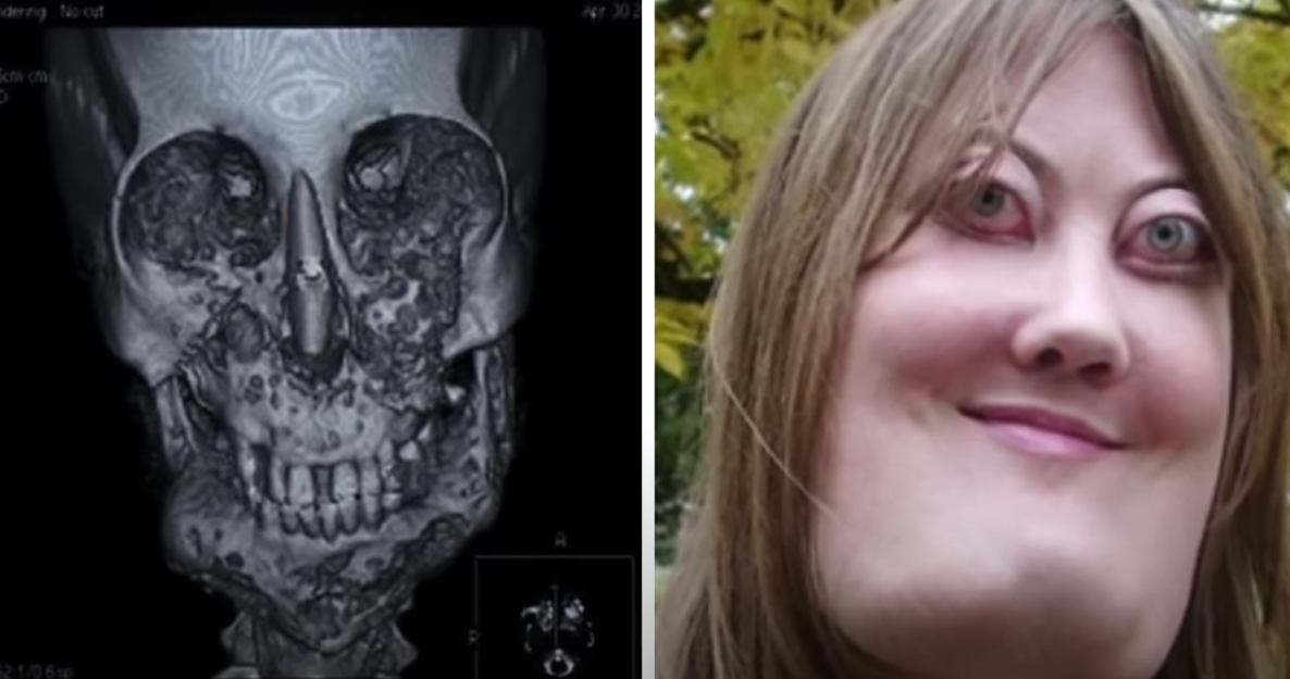 Женщина с необычной головой.