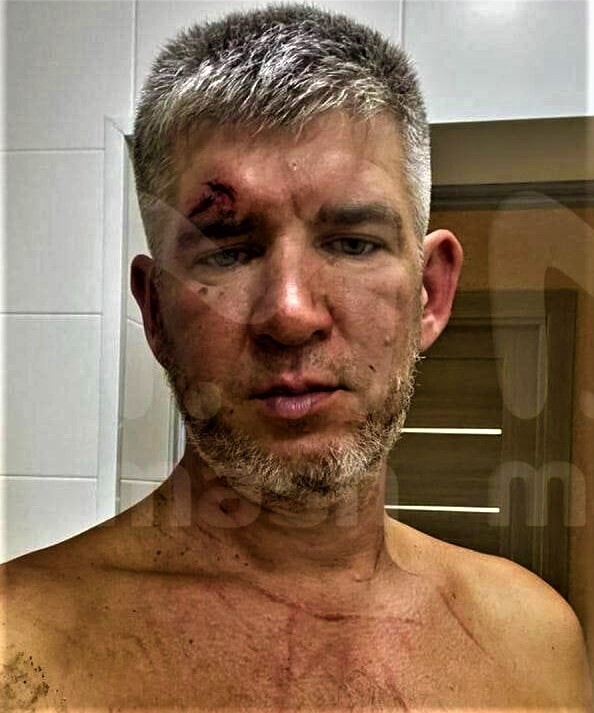 Сковородка как аргумент в споре супругов: Шекспир нервно курит за углом. Ему и не снились такие страсти