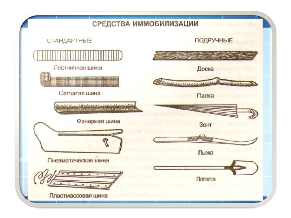 Иммобилизация, как вести себя до приезда медиков