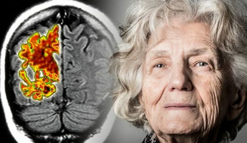 Деменция. Проведение судебно-психиатрической экспертизы. Продолжение