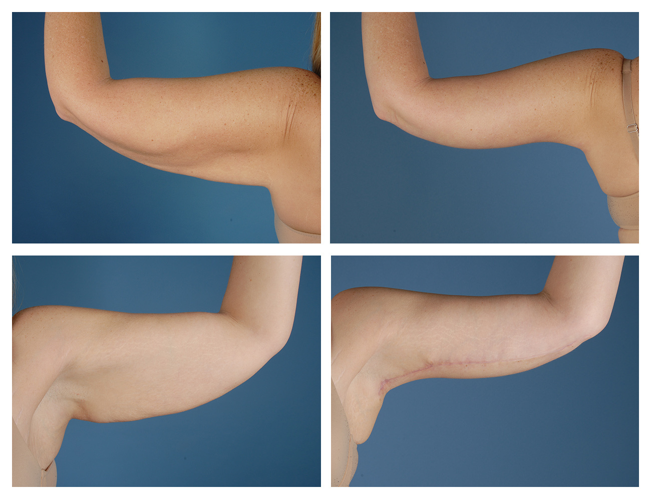 Мифы о пластических операциях