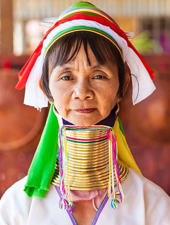 Женщина-Жираф Наконец-То Сняла Кольца С Шеи Спустя Пять Лет