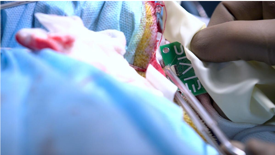 Российские ученые успешно установили зрительный имплантат обезьяне (ФОТО)