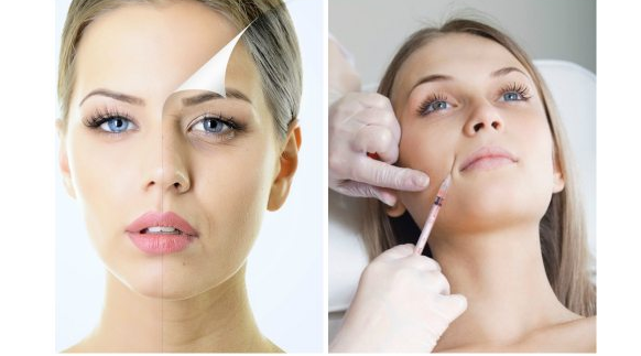 Микроботокс- на тропе войны с порами, акне и угрями