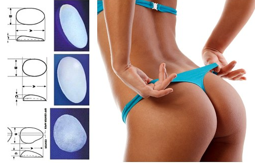 Пластика ягодиц: виды и особенности глютеопластики