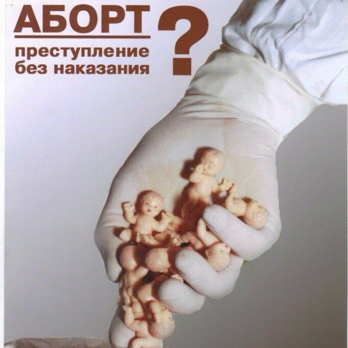 Аборт – это узаконенное убийство или способ избавиться от нежеланных детей? Нужно ли вывести аборты из ОМС?