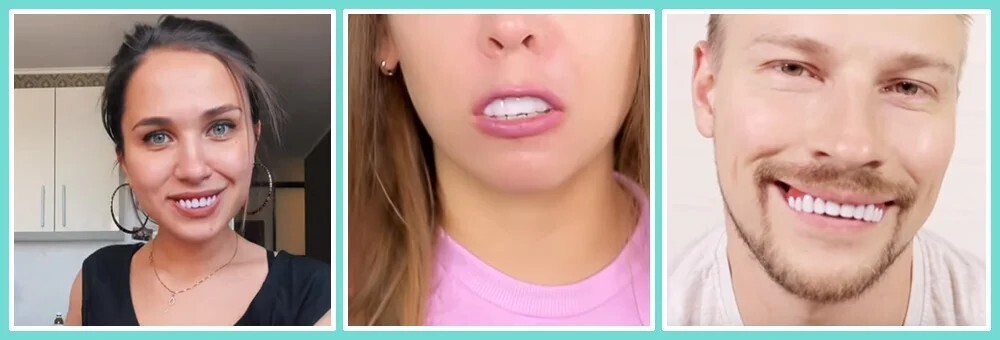 Люди заказали дешёвые виниры в Интернете: ожидание и реальность после получения и примерки