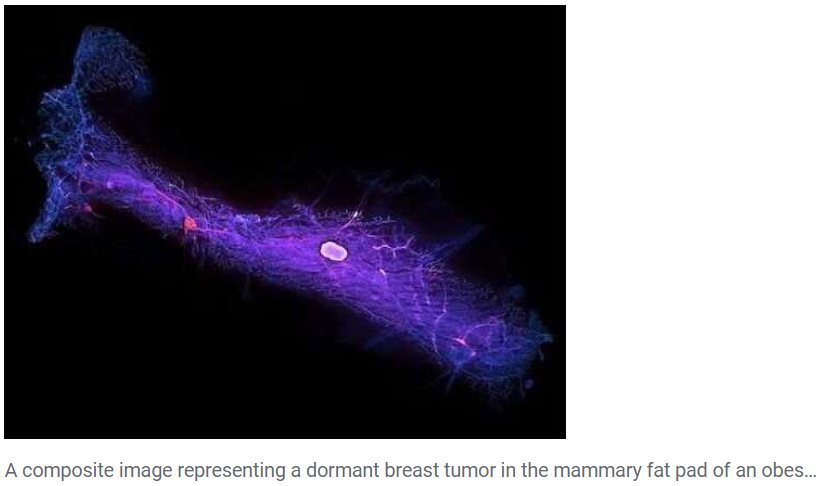 Ожирение повышает риск заболевания раком. Почему?