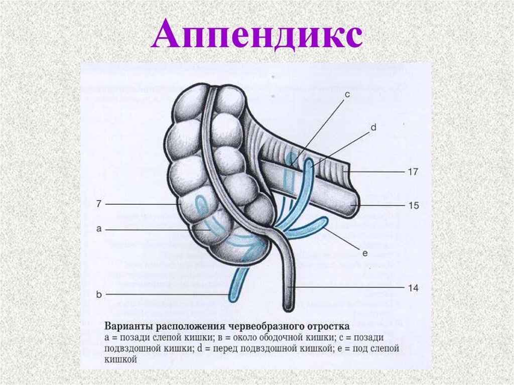 Где расположен аппендицит у человека схема расположения