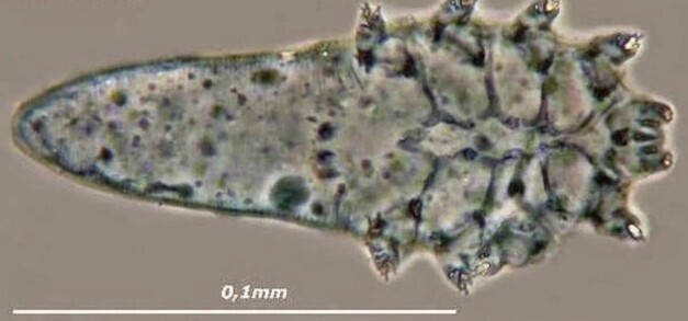 Ваше лицо покрыто тысячами таких, и они не всегда хороши