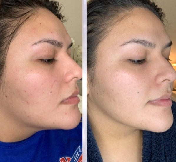 Ощутите силу витамина С и гиалуроновой кислоты с отбеливающей сывороткой JoyPretty