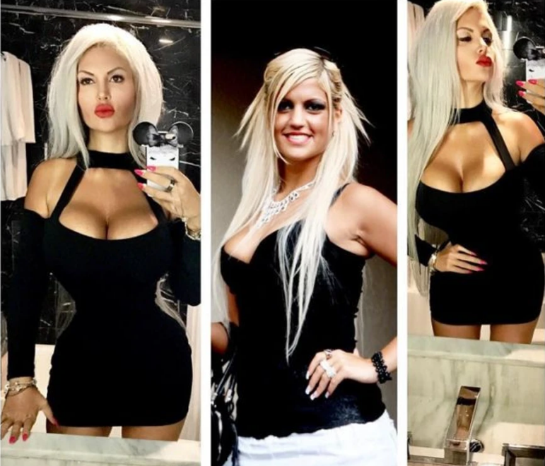 Девушка решила удалить рёбра ради 40 - ка сантиметровой талии: фото до и после