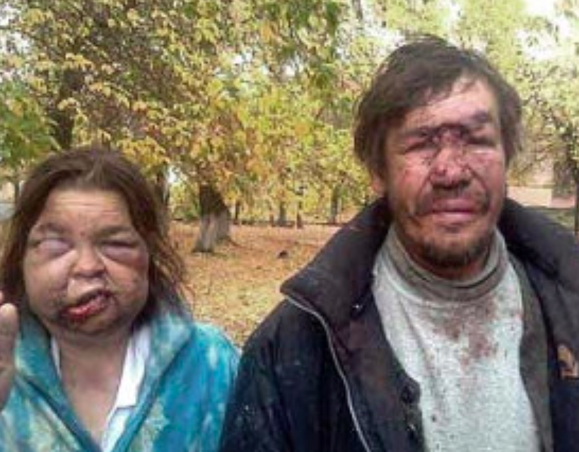 О возрождении в России ЛТП времён СССР. Опрос