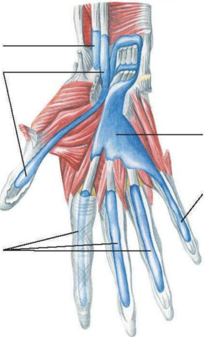 У-образная флегмона кисти или почему общий анализ крови берут из четвертого пальца?