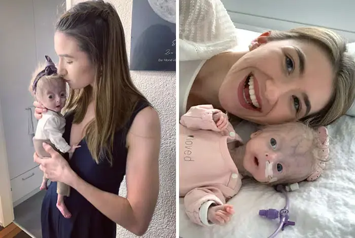 ТОП Фотографии необычных людей доказывающие, что генетику трудно игнорировать.