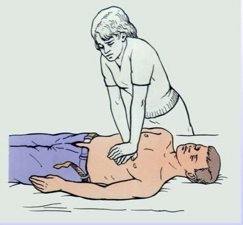 Первая помощь при потере сознания, остановке дыхания и остановке кровообращения.