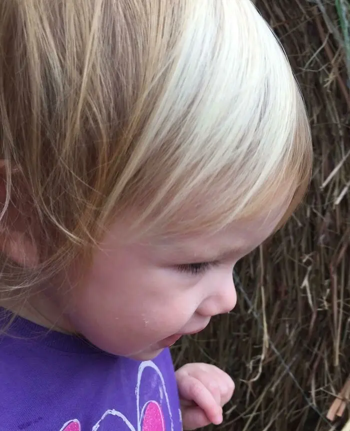 ТОП Фотографии необычных людей доказывающие, что генетику трудно игнорировать.