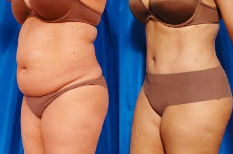 Благодаря этому капустному супу жировые отложения в ужасе сбегут от вас и никогда не вернуться. Забытый рецепт наших предков