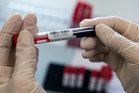 Ниже перечислены основные опасности, связанные с артериальными бляшками.