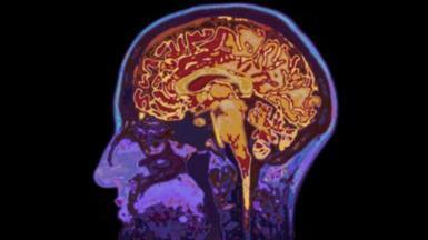 Адвокат Тайра Николса призывает законодателей принять срочные реформы полиции