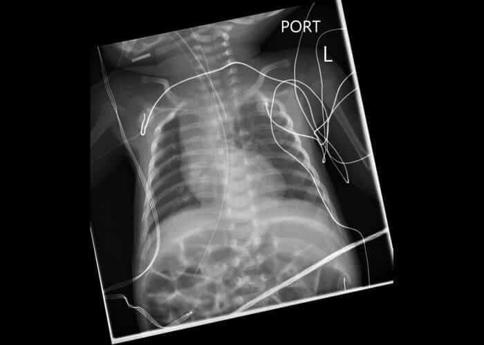 Люди с лишними частями тела.