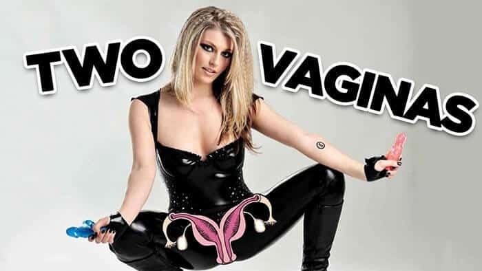 Люди с лишними частями тела.