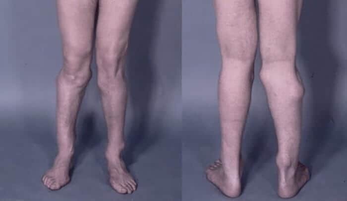 Люди с лишними частями тела.