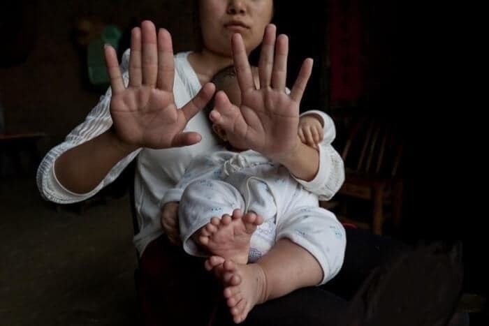 Люди с лишними частями тела.