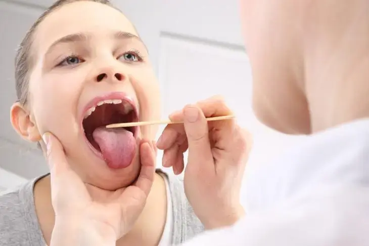 Гипертрофия миндалин у детей - причины, симптомы, лечение