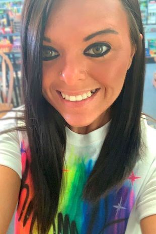 От пристрастия к вейпингу женщина находилась на аппарате жизнеобеспечения чтобы поддерживать состоянием лёгких.