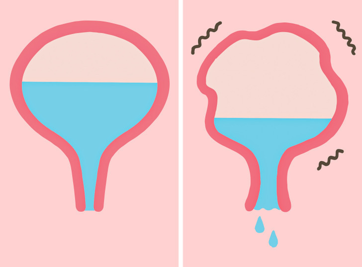 Почему нельзя сдерживать мочу