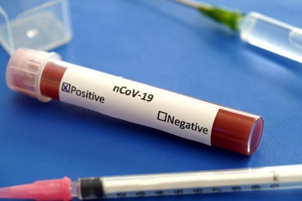 Вирус Covid может повысить риск заражения другими серьёзными заболеваниями