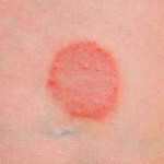 Нетрадиционный метод лечения , который мне помог.