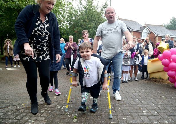 Ребёнку пришлось ампутировать ноги из-за жестокого обращения матери.